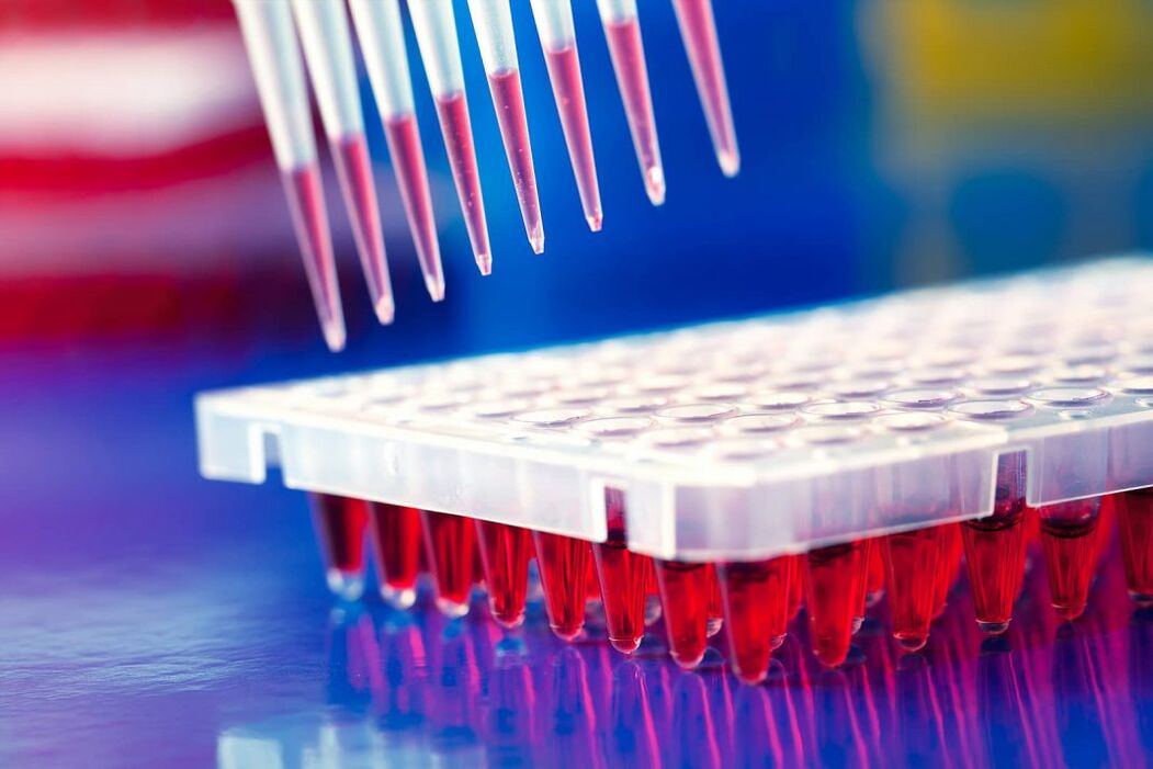 immunoloogiline vereanalüüs parasiitide tuvastamiseks