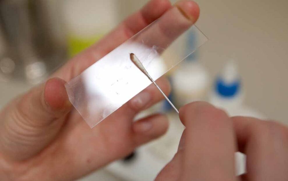kraapimine parasiitide olemasolu tuvastamiseks kehas